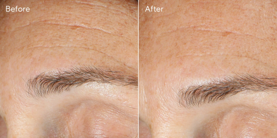 Murad RESURGENCE Replenishing Multi-Acid Peel