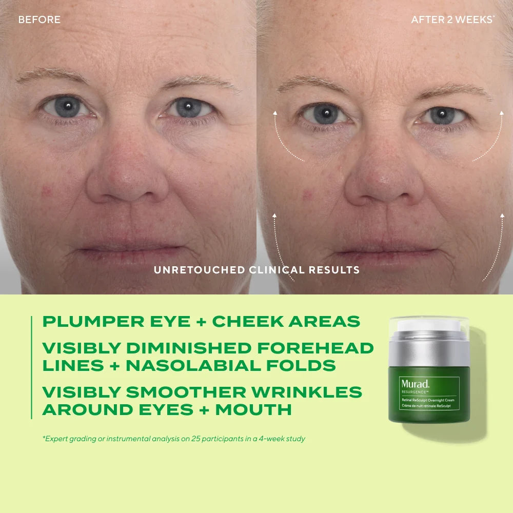 MURAD RESURGENCE RETINAL ReSCULPT OVERNIGHT CREAM