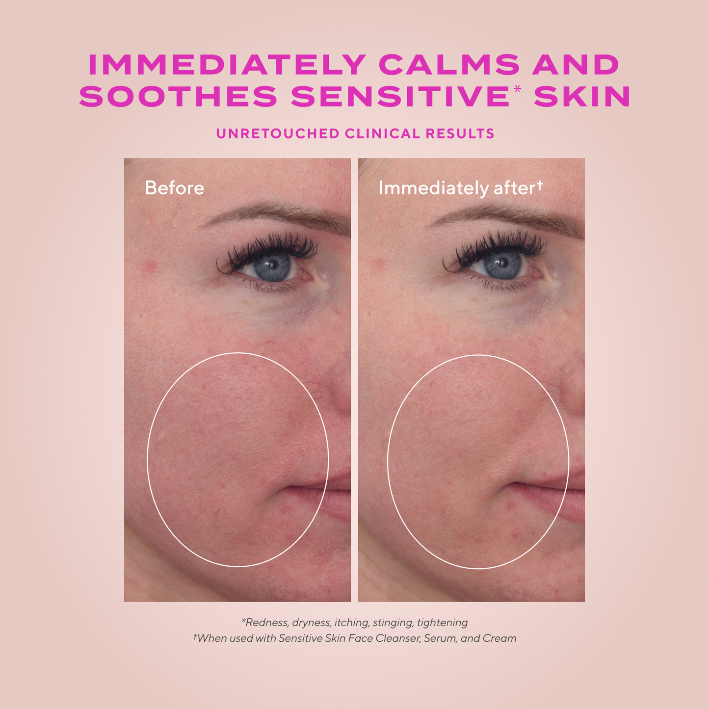 Murad HYDRATION Heartleaf Calming Cream