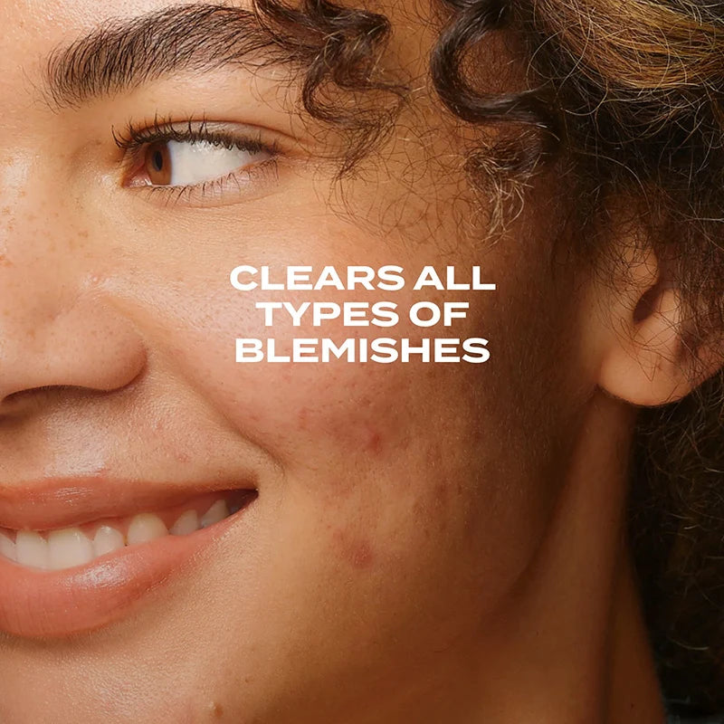 Murad BLEMISH CONTROL Biome-Balancing Clear & Prevent Blemish Treatment Serum