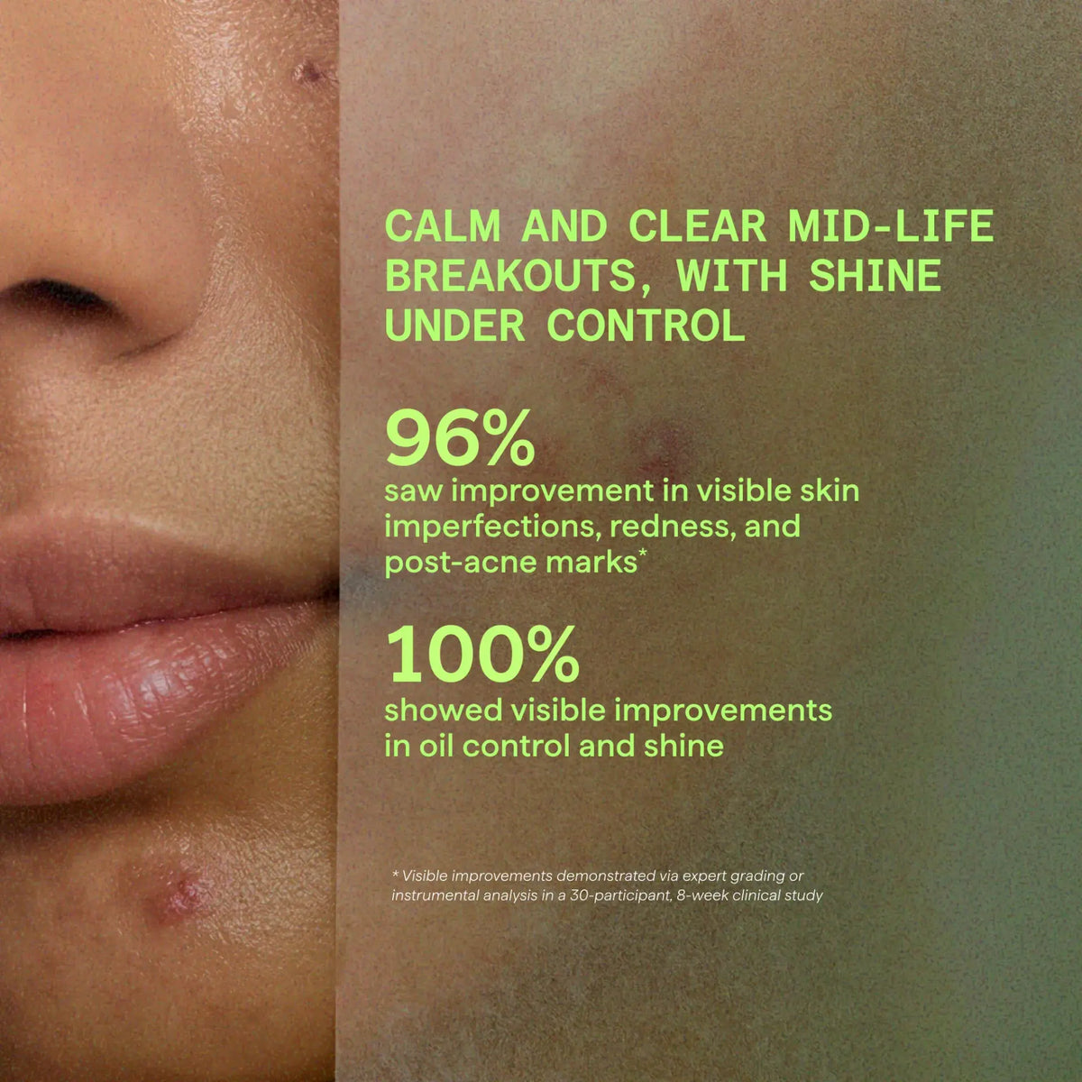 Murad BLEMISH CONTROL Biome-Balancing Clear & Prevent Blemish Treatment Serum