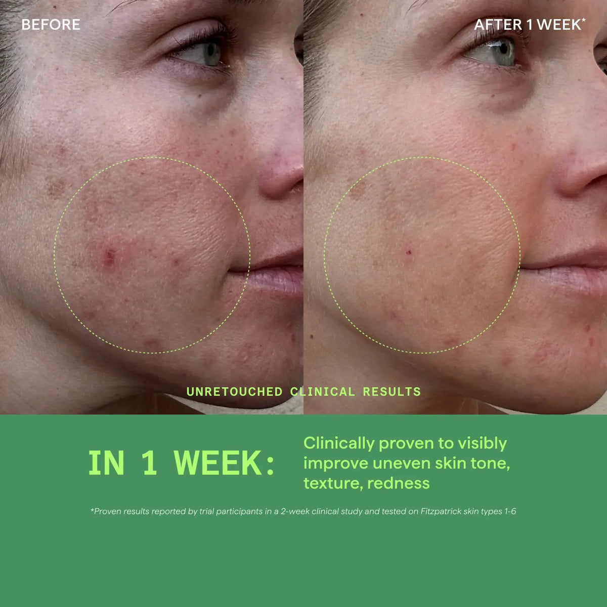 Murad BLEMISH CONTROL Biome-Balancing Clear & Prevent Blemish Treatment Serum