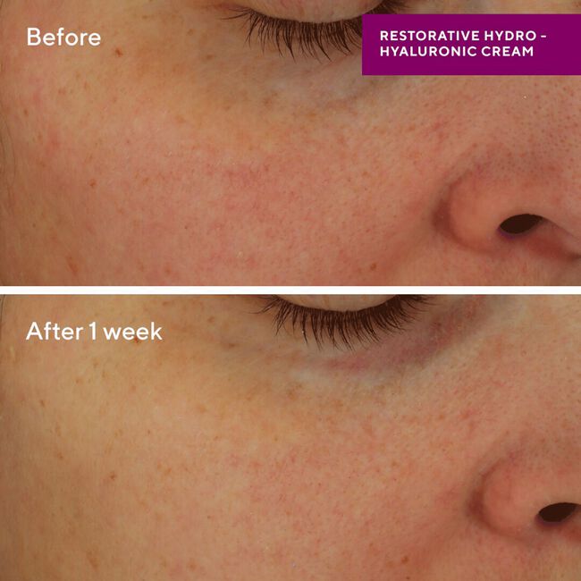 Murad HYDRATION Restorative Hydro-Hyaluronic Cream