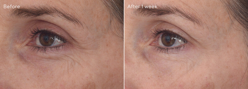 Murad RESURGENCE Retinal ReSculpt Eye Treatment