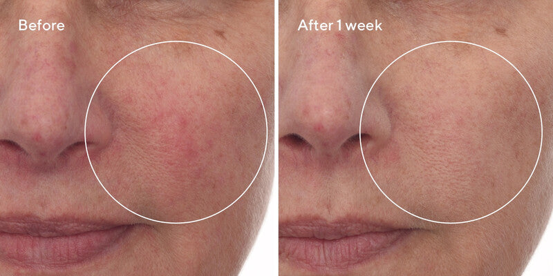 Murad HYDRATION Cellular Hydration Repair Serum